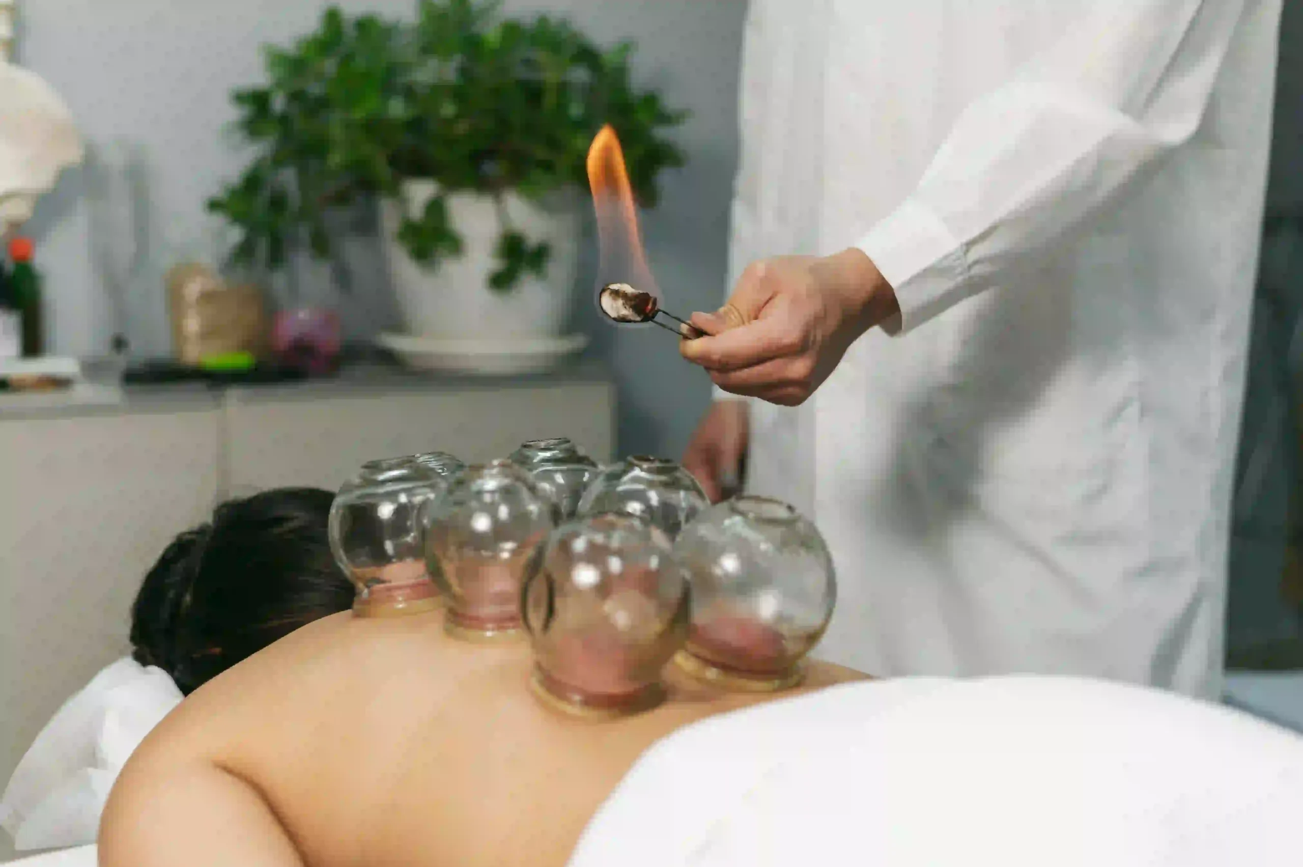 cupping therapy madurai